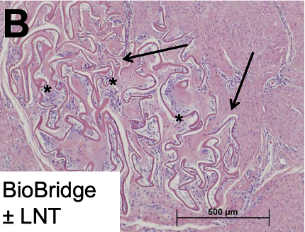 Histological analysis of the BioBridge scaffold