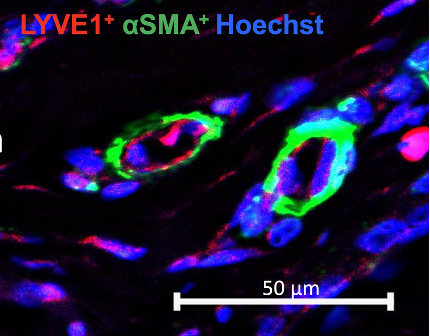 Confocal microscopy of newly formed lymphatic structures